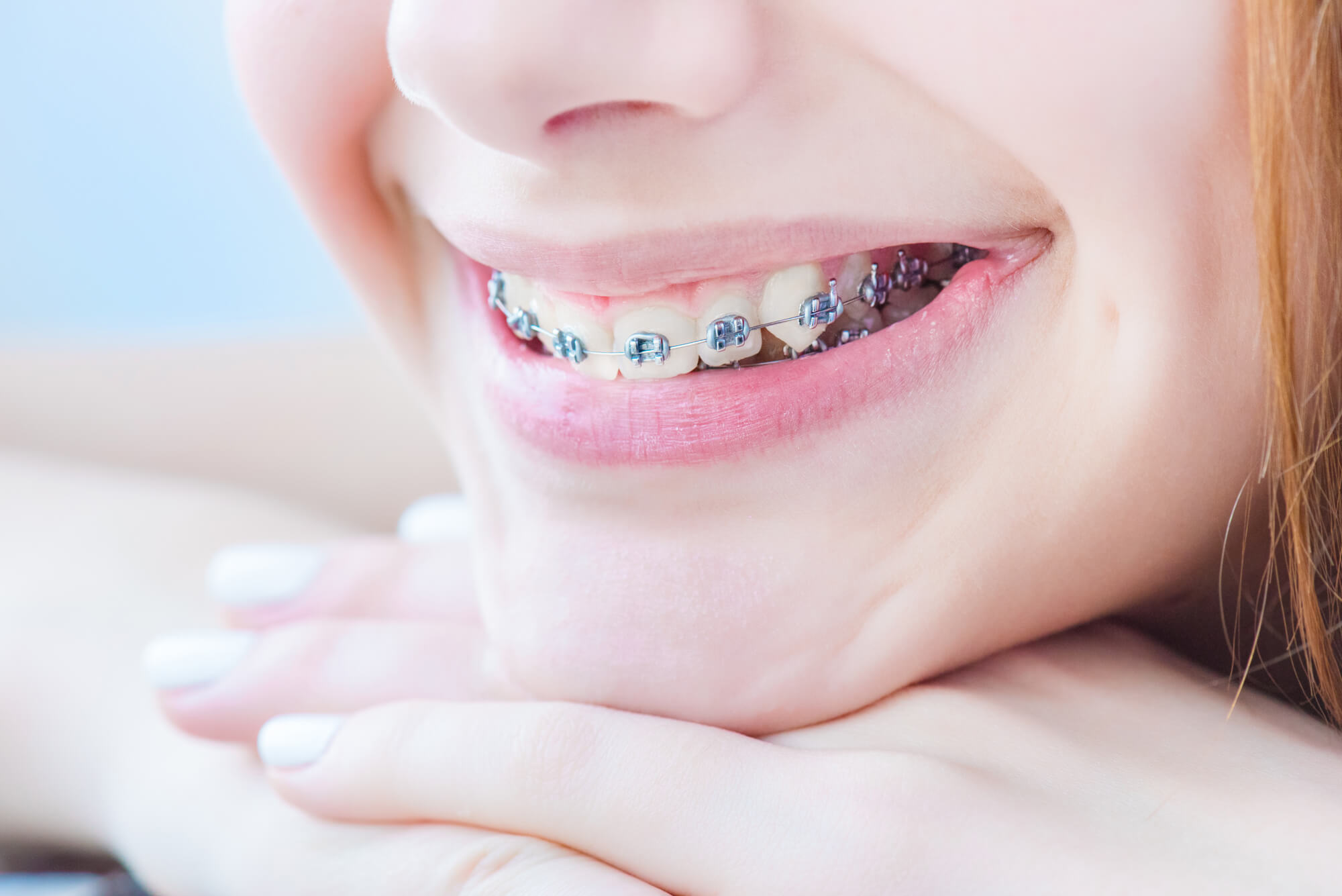 Early Orthodontic Treatments In Rocklin